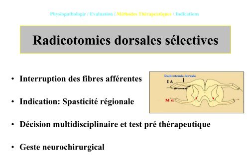 Le traitement de la spasticitÃ© chez l'enfant Infirme Moteur ... - SOFOP