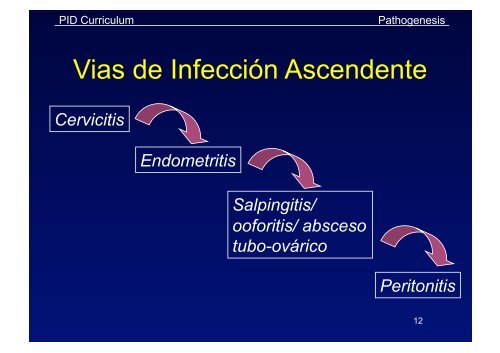 ENFERMEDAD PELVIANA INFLAMATORIA ( EPI ) - IGBA