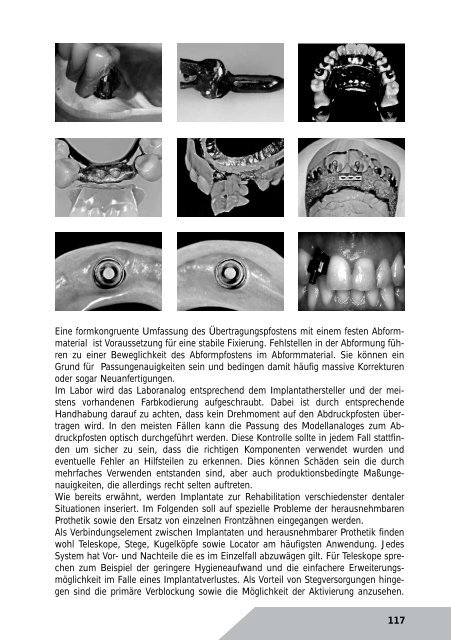 Kurzreferate 2011 - Arbeitsgemeinschaft Dentale Technologie