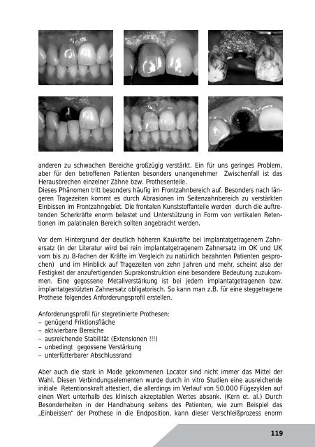Kurzreferate 2011 - Arbeitsgemeinschaft Dentale Technologie