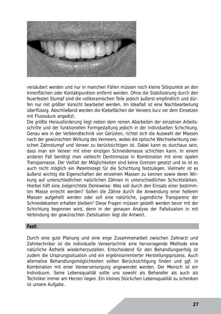 Kurzreferate 2011 - Arbeitsgemeinschaft Dentale Technologie