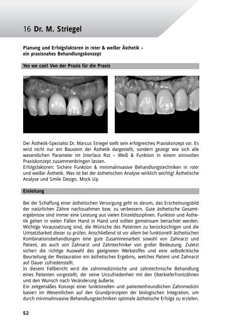 Kurzreferate 2011 - Arbeitsgemeinschaft Dentale Technologie