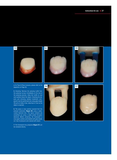 Cercon ceram kiss - DENTSPLY Prosthetics