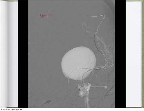 Thaweesak Aurboonyawat, MD, M.Sc. - Neuroscience.mahidol.ac.th ...