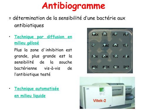 Pieges de l'antibiogramme â DESC MU 2012-13