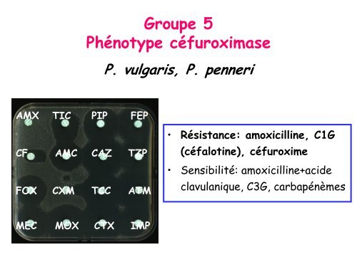 Pieges de l'antibiogramme â DESC MU 2012-13