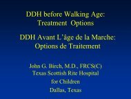 DDH before Walking Age - CHU Sainte-Justine - SAAC