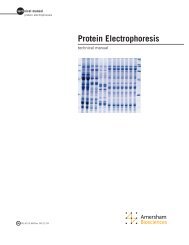 Protein Electrophoresis - Kirschner Lab