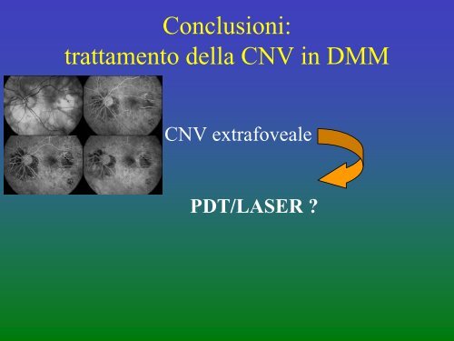 Classificazione della CNV e attuali possibilitÃ  ... - ABCsalute.it