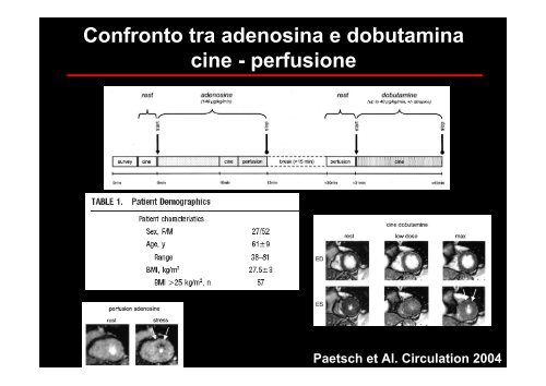 funzione e cinesi ventricolare sinistra a riposo e dopo stress ...