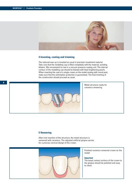 BICORTICAL® Implant with Ball Post - Implant Direct