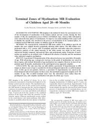 Terminal Zones of Myelination - American Journal of Neuroradiology