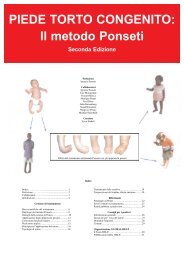 PIEDE TORTO CONGENITO: Il metodo Ponseti - sitop