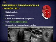 vía biosintética de hexosamina diabetes gestacional vía biosintética de hexosamina diabetes gestacional