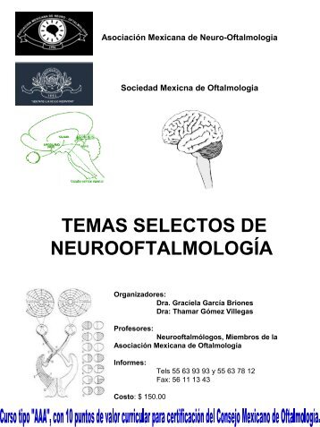 Diapositiva 1 - Sociedad mexicana de Oftalmología