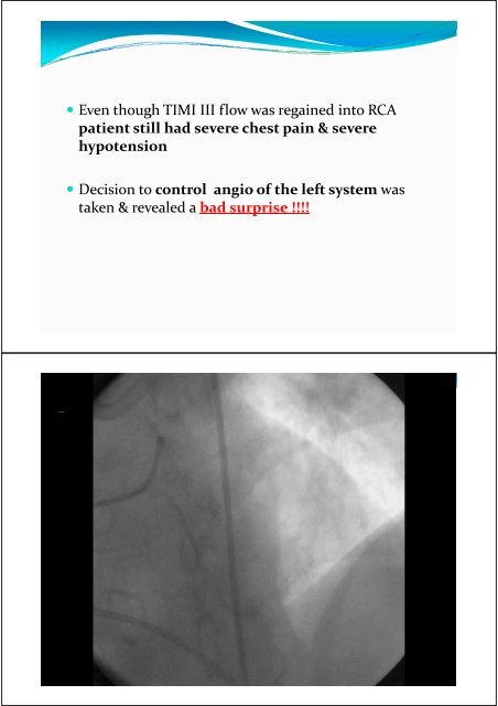 SHERIF WAGDY AYAD SRG Ass. Lecturer of cardiology Alexandria ...