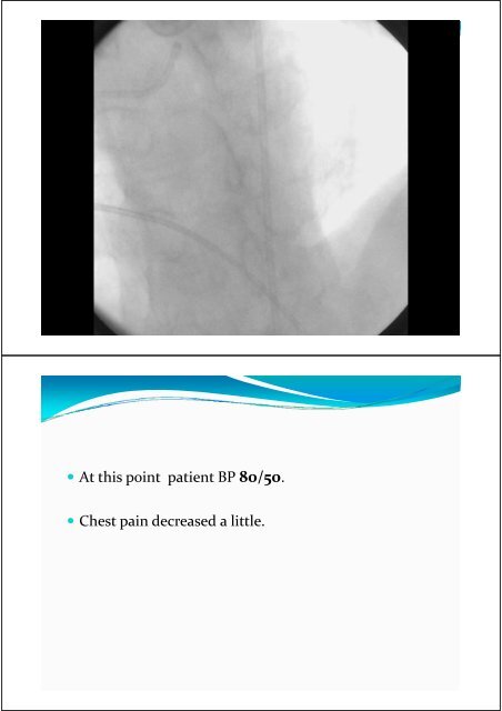 SHERIF WAGDY AYAD SRG Ass. Lecturer of cardiology Alexandria ...