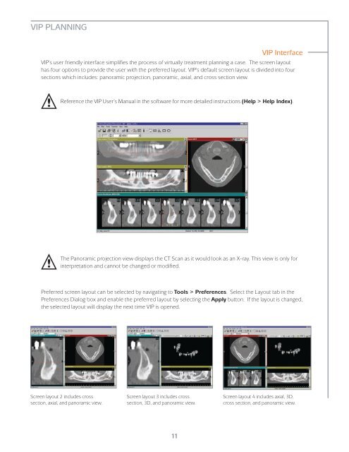 Virtual Implant Placement 2.1 - BioHorizons