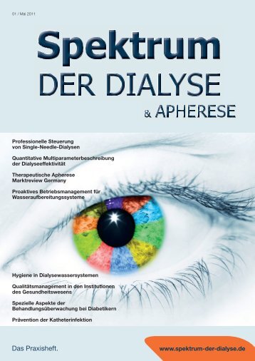 Single-Needle - Spektrum der Dialyse und Apherese