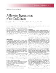 Addisonian Pigmentation of the Oral Mucosa - Cutis