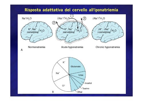 Encefalopatie anossica, ipoglicemica, diselettrolitica Encefalopatie ...
