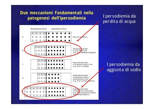 Encefalopatie anossica, ipoglicemica, diselettrolitica Encefalopatie ...