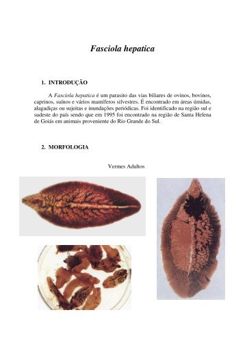 Fasciola hepatica - Ucg