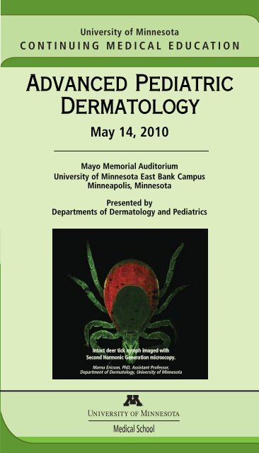 Advanced Pediatric Dermatology - University of Minnesota ...