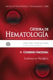 Linfoma No Hodgkin