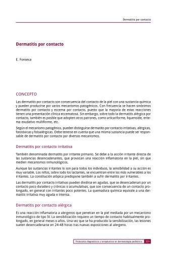 Dermatitis por contacto