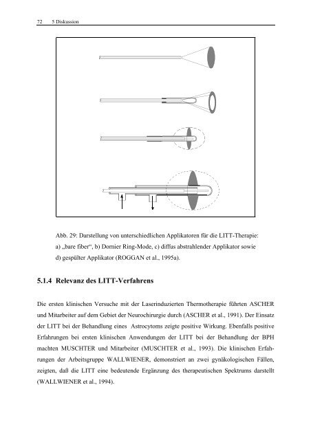 Isabela Schmitt Untersuchungen zum Einsatz der Laser-induzierten ...