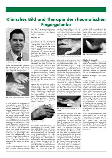 Klinisches Bild und Therapie der rheumatischen Fingergelenke