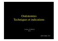 Osteotomies genou - ClubOrtho.fr