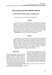 Actinomicosis del Hueso Maxilar Superior