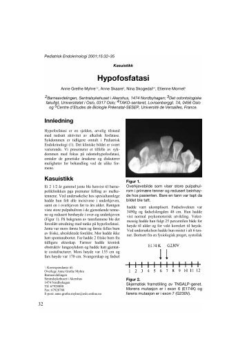 Kasuistikk: Hypofosfatasi - Pediatrisk Endokrinologi