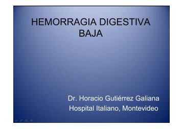 HEMORRAGIA DIGESTIVA BAJA