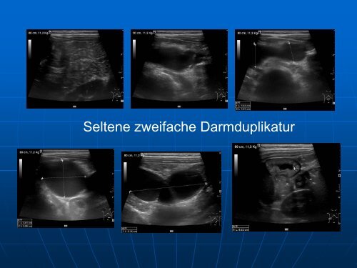 Sonographie