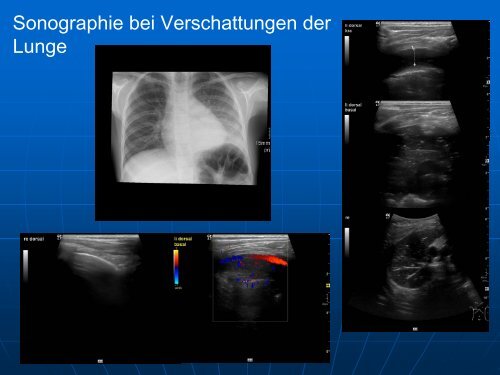 Sonographie