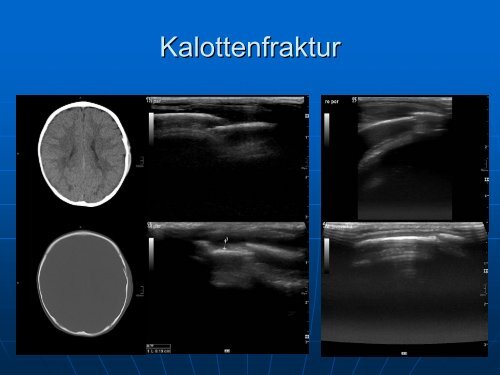 Sonographie