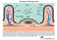 Ulcerative colitis.pdf - Immunopaedia