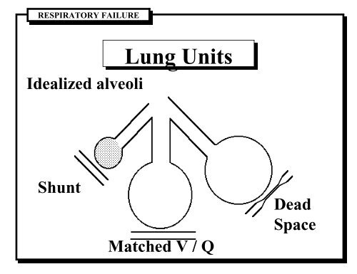 Respiratory Failure in Children - Nemours