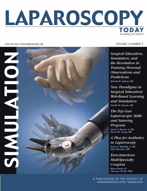 Pdf For Carey Laparoscopy Today