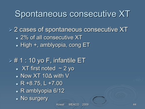 Consecutive exotropia - The Private Eye Clinic