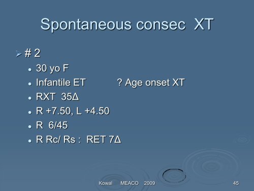 Consecutive exotropia - The Private Eye Clinic