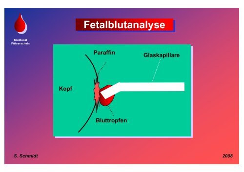 Schmidt: Fetalblutanalyse - Frauenklinik