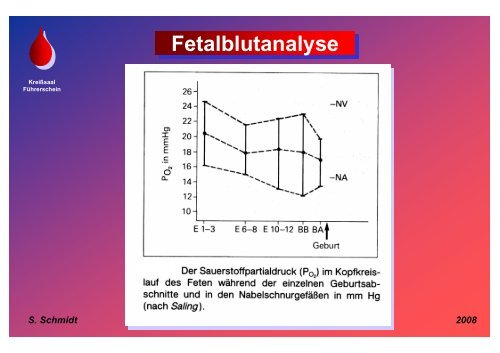 Schmidt: Fetalblutanalyse - Frauenklinik