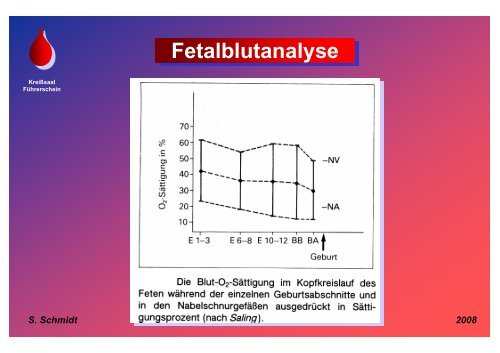 Schmidt: Fetalblutanalyse - Frauenklinik