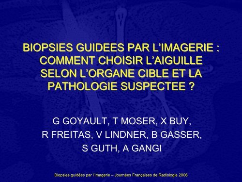 BIOPSIES GUIDEES PAR L'IMAGERIE : COMMENT CHOISIR L ...