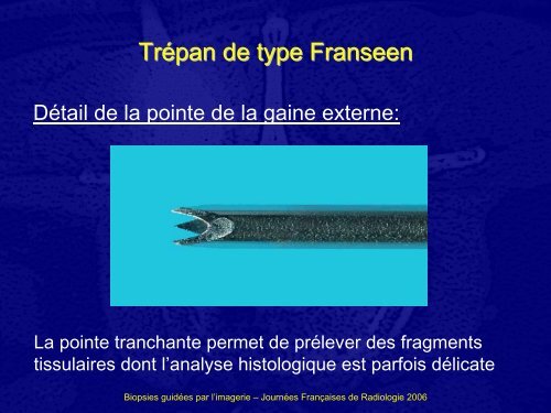 BIOPSIES GUIDEES PAR L'IMAGERIE : COMMENT CHOISIR L ...