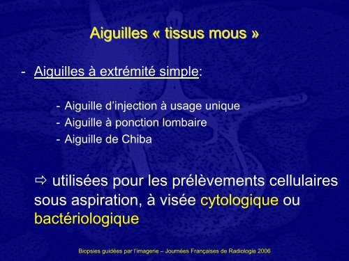 BIOPSIES GUIDEES PAR L'IMAGERIE : COMMENT CHOISIR L ...